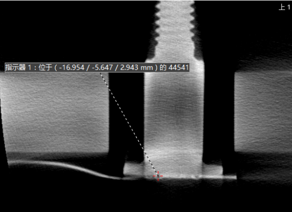 工業(yè)CT檢測案例